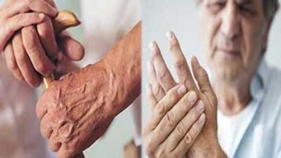 Parkinson hastalığı hakkında bilmeniz gereken her şey