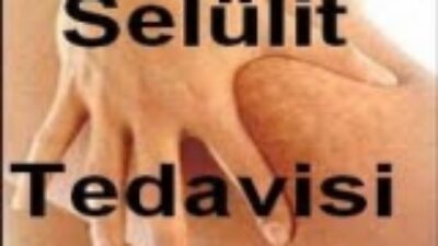 Usandım Artık Selülitten Nasıl Kurtulurum