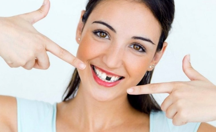 Kaybedilen dişler nasıl tamamlanmalı kestirilmeli mi implant mı? Uzmanlar açıklıyor!